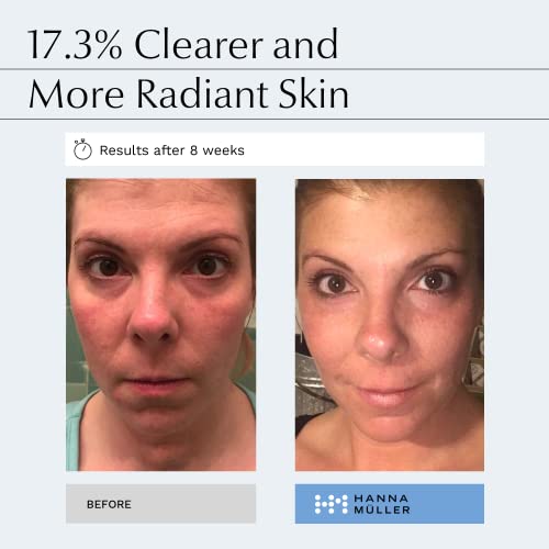 𝗪𝗜𝗡𝗡𝗘𝗥 𝟮𝟬𝟮𝟯* Pha Serum With 2 Phas & 1 Aha For Double Exfoliation - Pha Exfoliant Helps To Reduce Fine Lines And Wrinkles, Brightens And Hydrates Skin - Gentle For All Skin Types, 1 Fl Oz #TOP1