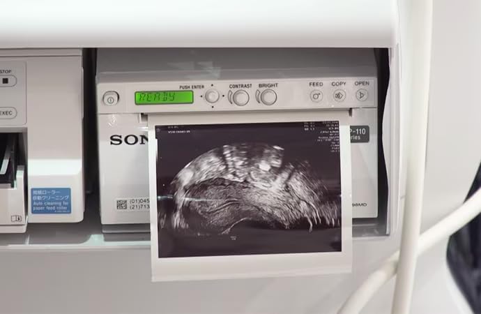 Amazon | UPP110HG ハイグロス ビデオプリンター ペーパー 超音波