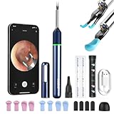 Ear Camera Wax Removal,Bebird Note 5 Ear Wax Removal Tool Camera Ear Tweezers with Camera,10 Megapixels Ear Otoscope Camera,6 Ear Spoon,Ear Cleaner with Camera for Ear Cleaning