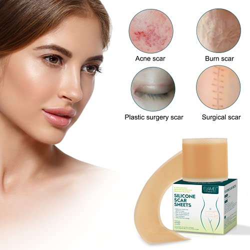 Silicone Scar Sheets (1.6” X 120” Roll-3M), Silicone Scar Tape Roll, Scar Silicone Strips, Reusable, Professional Scar Removal Sheets For C-Section, Surgery, Burn, Keloid, Acne Et #TOP3