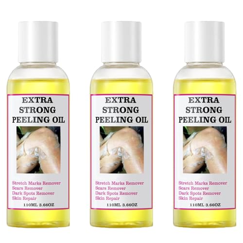 Generic Extra Strong Yellow Peeling Oil for Dark Skin - Exfoliating Solution for Body, Hand, Feet and Face - All Skin Types (110ML/3.88 Fl Oz)