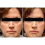 Vitamin C Serum 20% Pure L-Ascorbic Acid, Ferulic Acid, Vitamin E and HA and Hyaluronic Acid Serum with Vitamin B5 for Face and Eyes Natural Anti Aging Anti Wrinkle Set of 2 by Dr. Brenner - Image 5