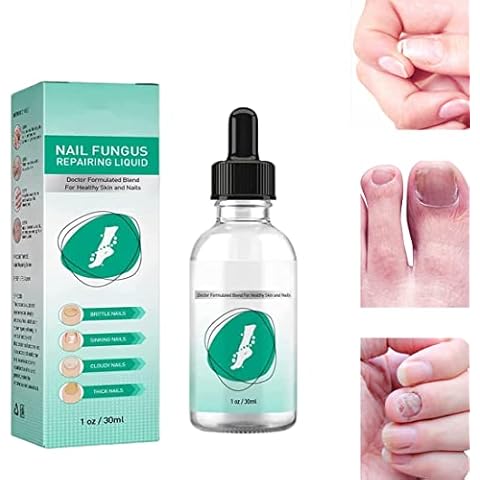 Kerassentials Toenail Fungus Treatment Oil , Best Repair Solution for Fingernails and Toenails , Fix & Renew Damage Fungal Nail, Broken, Cracked & Discolored Nails Cover