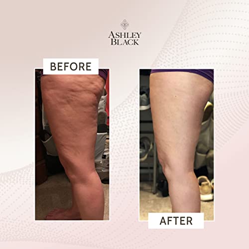 FasciaBlaster ProBlaster by Ashley Black – Ferramenta massageadora de celulite – Bastão de massagem