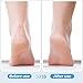 3 Pcs 4 in 1 Foot Brush for Use in Shower with Pumice Stone, Foot Rasp and Sandpaper, Foot Scrubber Brush for Feet, Dead Skin Remover for Foot Care