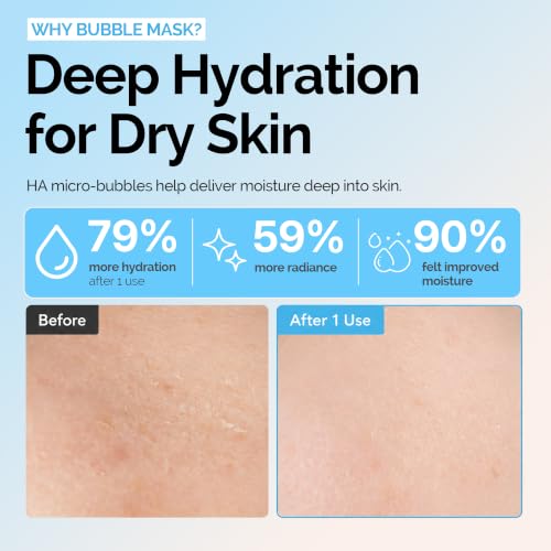 Image of Hyaluronic Acid Bubble Skincare Serum - Micro Bubble Mask Treatment | No Rinse 15 Seconds Korean Skincare, Contains Niacinamide & Hyaluronic Acid