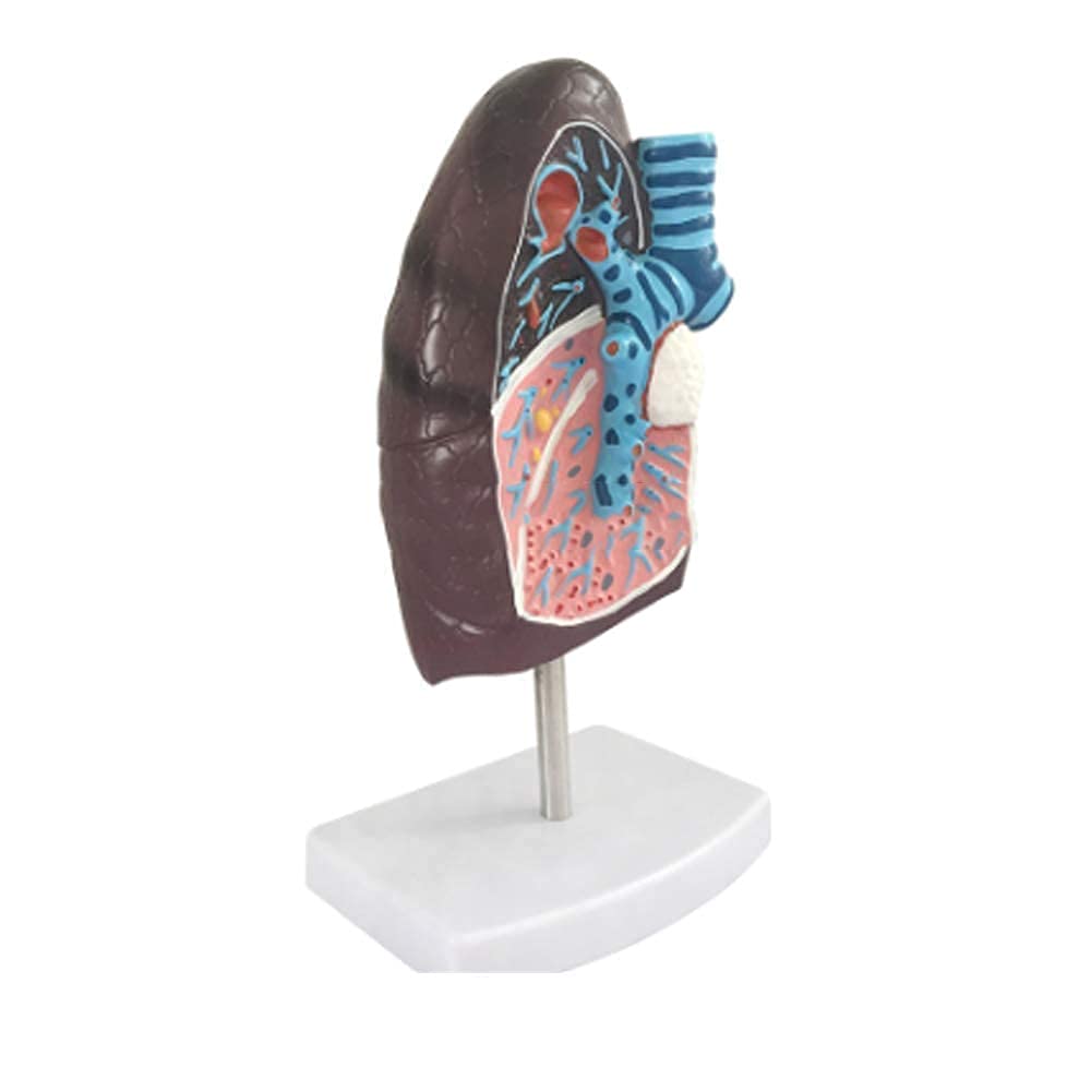 Zusammenbau-Montagemodell, Anatomie-Modell, Lungenorgan, menschliches pathologisches anatomisches Atmungssystem, Modell für Medizin, Biologie, Labor, Wissenschaft, Unterricht, Demonstration für Schul