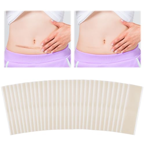 30 Pezzi Cerotti Silicone Cicatrici, Silicone Scar Sheets 4 x 15 cm, Cerotti in Silicone per Cicatrici Impermeabile e Traspirante, Cerotti Cicatrici per Cicatrici Chirurgiche e Cicatrici da Acne