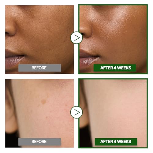 GOODAL Green Tangerine Vitamin C Cream [Advanced Ver.] – Vitamin C Cream with 5% Niacinamide | Fades Dark Spots, Boosts Radiance & Hydrates | Korean Skincare 1.69oz / 50ml