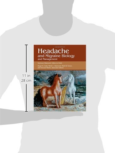 Headache And Migraine Biology And Management #TOP1