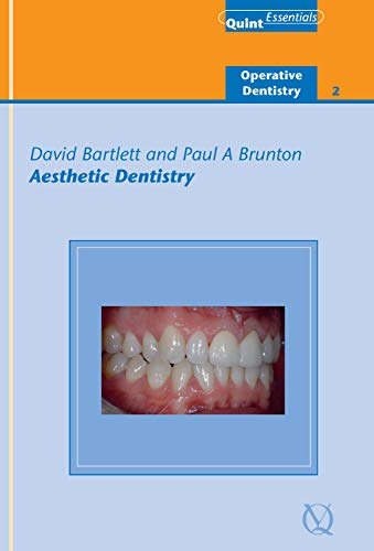 Aesthetic Dentistry: Operatinve Dentidtry - 2 (QuintEssentials of Dental Practice Book 19) (English Edition)