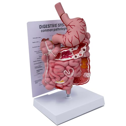 Image of Human Digestive System Model with Removable Stomach, GI-Tract and Colon, Includes Product Manual