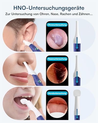 BEBIRD Ohrenschmalz Entferner mit kamera, 1920P HD Flexibler Ohrreiniger mit Pinzette, Ohrenreiniger Kamera mit Ersatzspitzen für Ohren/Nasen/Hals-Untersuchungen,Otoskop Ohr für Familie-SchwarzGold