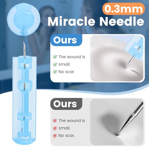 100er Pack Einweg Akne Pickel Nadeln, für Gesichtsfehler Schönheitssalon zu Hause