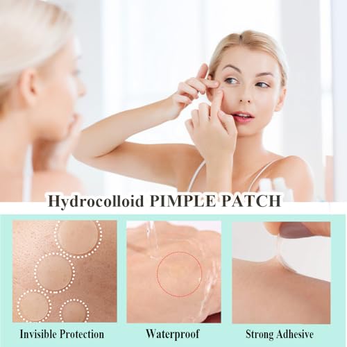Zemolo 300 Stück Pickel Patch Unsichtbare Hydrokolloid Akne Pimple Patch Tag & Nacht Akne pflaster Wasserdicht & Atmungsaktiv Absorptions Acne Patches