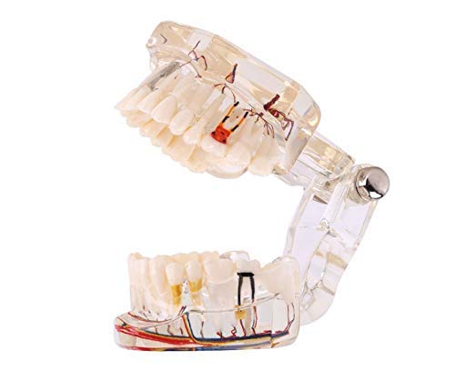 See full amazon price history chart for INDIAN PATIENT EDUCATION MODEL (CARIES,IMPLANT,NERVES) INDIAN PATIENT EDUCATION MODEL (CARIES,IMPLANT,NERVES) (B07DCTGGS1) Amazon Price History, Amazon Price Tracker