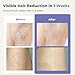 Ualans Laser Hair Removal Device Cordless, Painless & Permanent, 3 Weeks Faster Results, IPL Laser Hair Remover for Women Men with Ice-Cooling, Easy to Hold, Safe for Whole Body Use- IPL 008