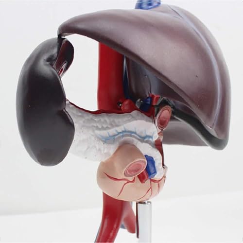 Modèle de pathologie du pancréas AMITD aide à l'apprentissage digestif en anatomie