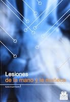 Lesiones de La Mano y La Muneca (Spanish Edition) 8480198230 Book Cover