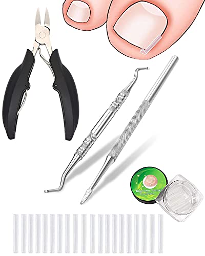 (50 +3) Pack Professional Ingrown toenail Correction treatment Kit,50 pcs Ingrown Toenail Corrector Straightener Strips with 2 pcs Ingrown Toenail File Lifter And 1 Ingrown Toe Nail Clippers