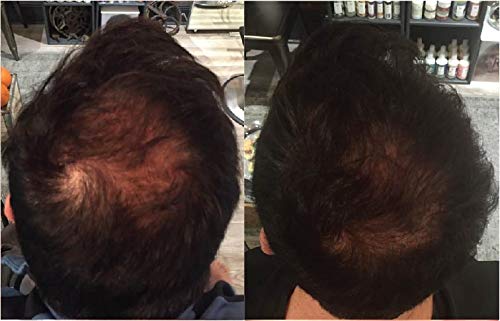 Zenagen Revolve Thickening and Hair Loss Shampoo Treatment for Men, 32 oz.