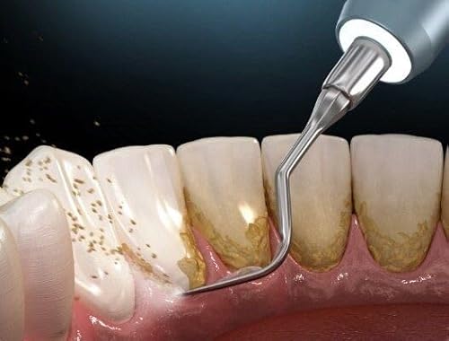 Periodontal Dentistry Tips: Daily Habits for Stronger Gums