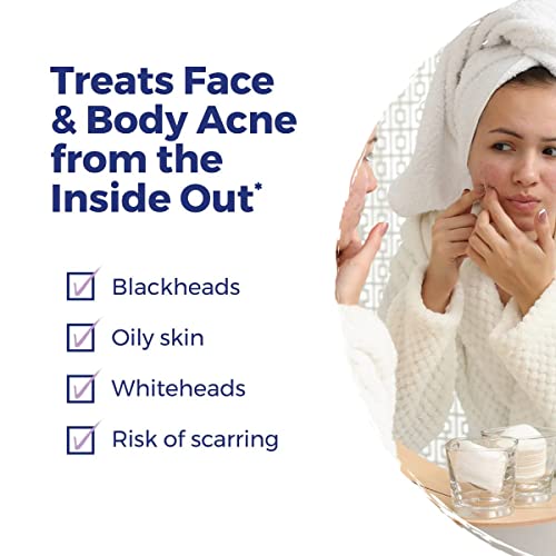 image for Boiron Acne Relief Kit for Blackheads, Oily Skins, Whiteheads on The F