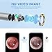 ScopeAround Wireless Otoscope with Light Ear Camera, 3.9mm Ear Wax Removal Tool Camera, 720P HD with 6 LED Lights, WiFi Wireless Otoscope, Ear Scope Compatible with Android and iPhone