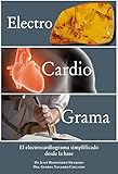 El electrocardiograma simplificado desde la base
