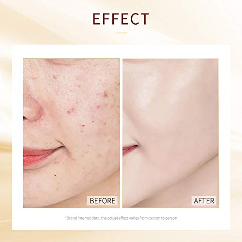 Image of Snail Extract Skin Treatment Mask - Moisturizing, Hydrating, Brightening, Soothing