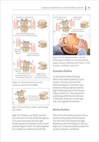 Spinal Manipulations and Mobilization Techniques