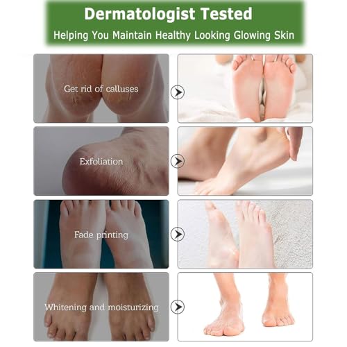 5 pares Mascarilla exfoliante pies,calcetines exfoliantes de pies, peeling pies, foot peel mask, probada dermatológicamente, eficaz para callos pies eliminar Expert Care - imagen 5