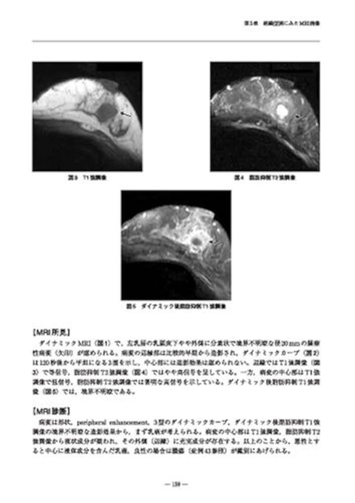 乳房MRIアトラス【裁断済】 乳房MRIアトラス【裁断済】送料 無料 通販