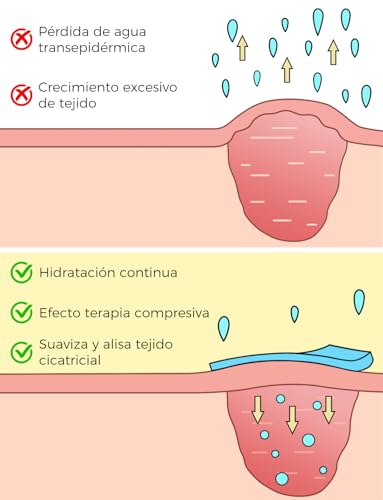 Miniatura 4 de Parches Cicatrizantes De Silicona 4x150 Cm - Médicos, Reutilizables - Para Cesáreas, Queloides - Transpirables E Impermeables