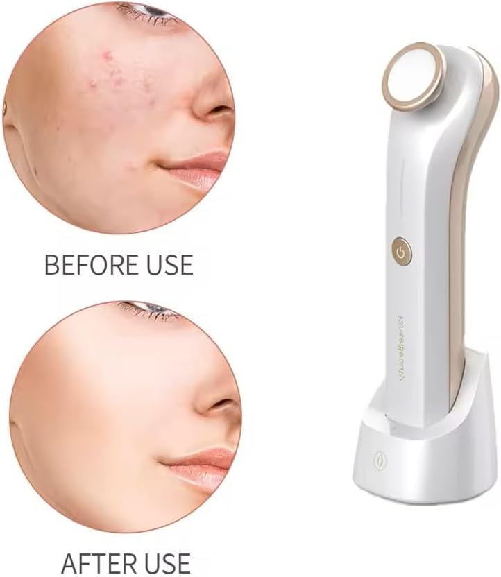 KinseiBeauty Plasma Facial Device, Ozone Skin Care Machine, Face Massager for Acne Treatment, Brightening, Anti-Wrinkle - Image 6