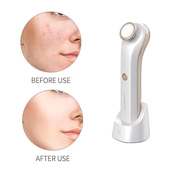 Amazon.com: KinseiBeauty Plasma Facial Device, Ozone Skin