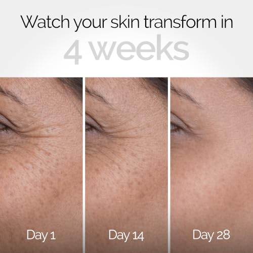 Image of Personal Touch Backshift 0.3% Granactive Retinoid Night Cream | Repairs Wrinkles & Fine Lines | Improves Skin Firmness & Texture | Beginner-Friendly Retinoid | Anti-Aging Face Cream for Women & Men | All Skin Types | 15g