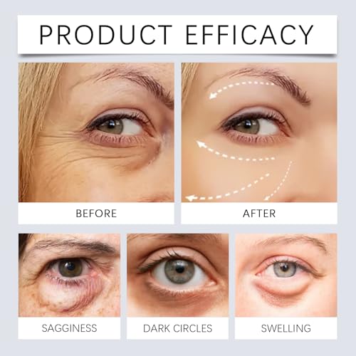 VivaBloom Retinol Eye Cream for Under Eye Bags Wrinkles & Dark Circles Treatment Hydrating Face Care Serum Corrector 0.71OZ (3)