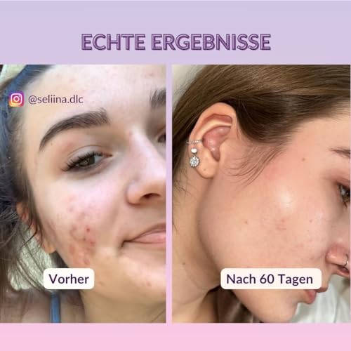 Gesichtsmasken von Mother Nature Cosmetics – Totes Meer Maske 250g vegan