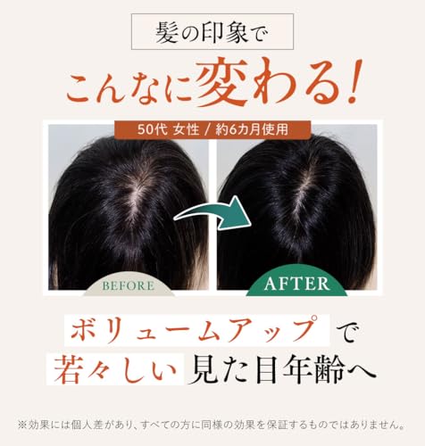 ウェルベスト 女性のための育毛剤 薬用リリィジュ RICH 75ml（約1ヵ月分） 女性用 育毛剤 (薄毛 抜け毛) 医薬部外品 育毛 (正規品) 使い方ガイド付き
