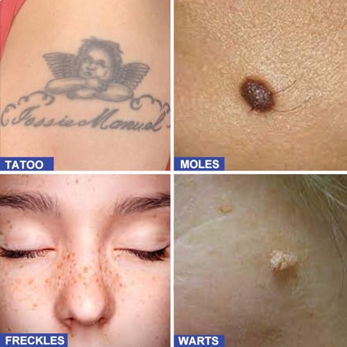 rechargeable blue pen with glasses medium white