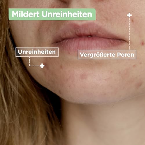 Mixa Anti-Unreinheiten Comfort Cleanser, Für zu Akne neigende und sensible Haut, Glättet das Erscheinungsbild der Poren, Mit Salicylsäure und Squalan, Geeignet für Gesicht & Hals, Hypoallergen, 150 ml