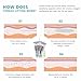 D.seahorse Pdo Thread For Face Lift Cog 6D L(tip) 19G 100mm Blunt tip,360R design safely and effectively lifts the skin, long-lasting firming (10pieces per pack)