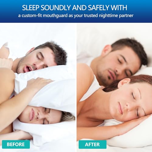 Image of 4 Pcs Night Guards for Teeth Grinding, Comfort Fit Mouth Guard for Nighttime Protection, Reusable Teeth Guard for Clenching Prevention, Dental Protection