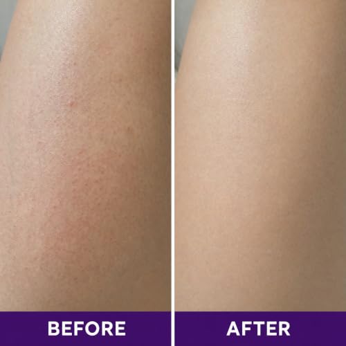 Image of DERMAdoctor KP Bump Eraser Body Scrub with 10% AHAs + PHAs for Keratosis Pilaris, Dry, Rough, and Bumpy Skin, Dermatologist Formulated Exfoliating Body Scrub with Glycolic and Lactic acids - 24 oz