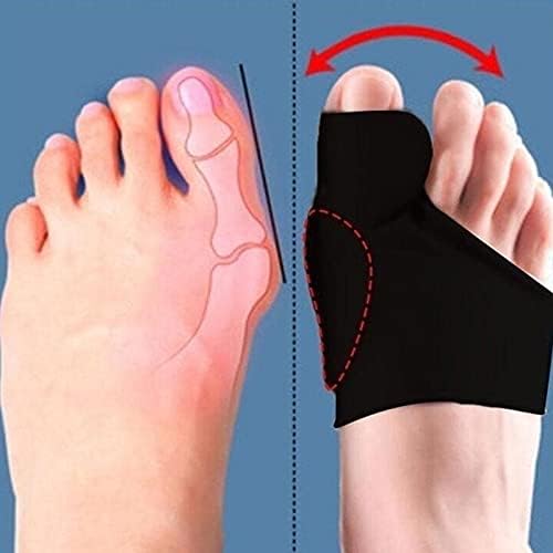 MUSUMI 2Pcs Bunion Corrector Hallux Valgus Corrector Relief Pain Toe Separators Pedicure Tool Bone Thumb Orthopedic Braces Foot Protector Splint (Clear L)