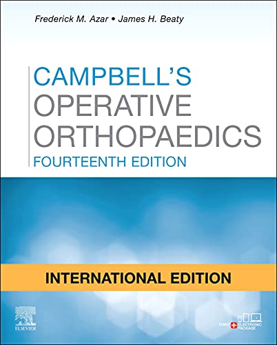 Campbell's Operative Orthopaedics, E-Book Campbell's Operative Orthopaedics, E-Book