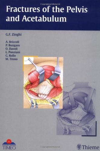Fractures of the Pelvis and Acetabulum Fractures of the Pelvis and Acetabulum