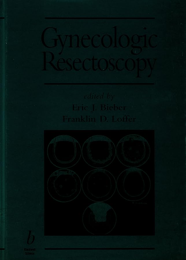 Gynecologic Resectoscopy (Minimally Invasive Gynecology): 9780865423497 ...