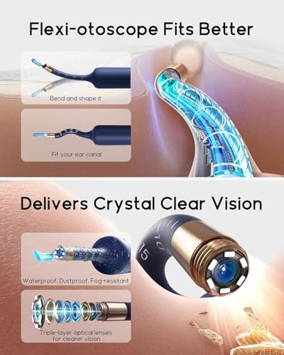 Image of Earsight Plus R37R Ear Cleaning Camera Wax Removal Tool kit, Flexible Ear Scope Otoscope Camera Light, Visual Ear Picker Wireless Earwax Remover Tweezers for Adults & Kids (Premium Ear Wax)